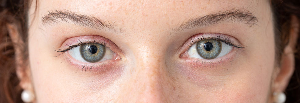 Blue-Eye-after-55-V-