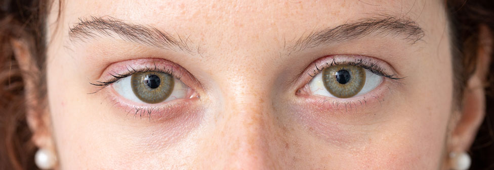 Blue-Eye-after-55-X-